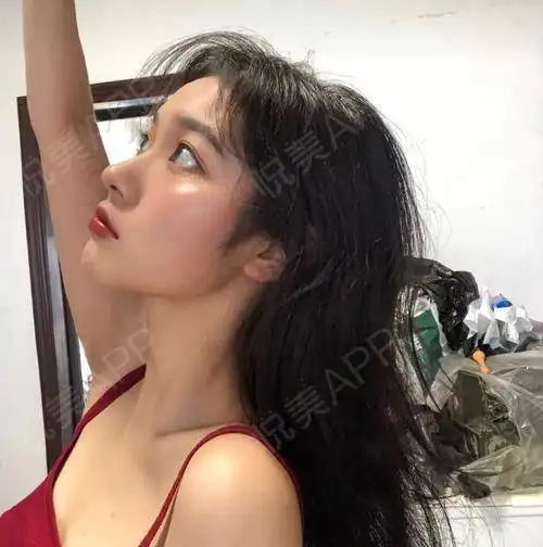 哈喽,宝贝们看着这个疤痕越来越浅真的好开心呢,一...补水保湿悦美整形