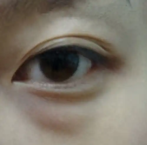 如何区分眼袋和卧蚕