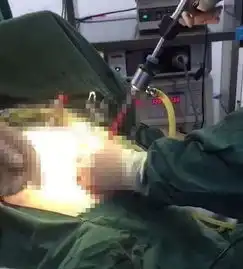 吓人榆林一男子体内取出500余粒石头