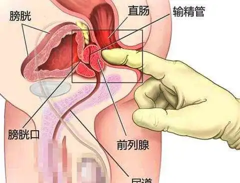 男人的生命腺,自己动手按摩1个位置,从此痛快淋漓不怕腺痛