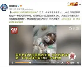 14岁少女学抖音重度烧伤,抖音难推审核失责之罪