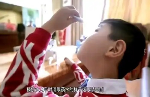 3岁男孩误将502胶滴入眼中,妈妈机智处理,连医生都称赞