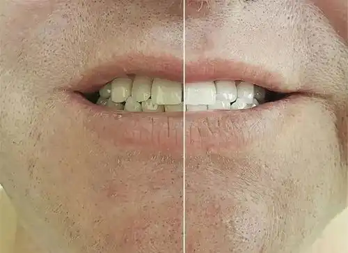 男性45岁后,若2处变大,2处缩小,别不承认,衰老也许正在靠近