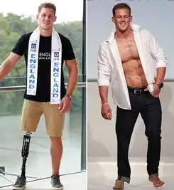 励志英28岁截肢男模成功当