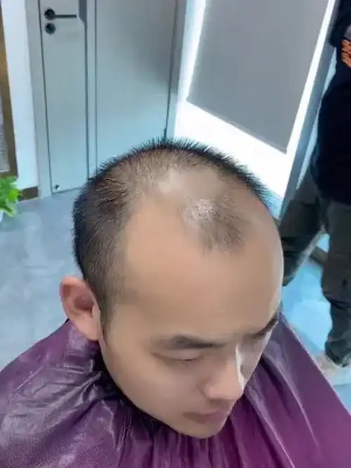 南阳到武汉的90后高中老师,才教两年书就脱成这样了,现在的学生让老师真的头疼吗假发男士假发长沙假发武汉假发