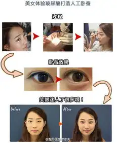 你分得清自己的是眼袋还是卧蚕么