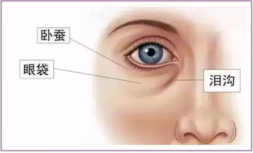 快收藏这3种方法去眼袋,彻底又省钱