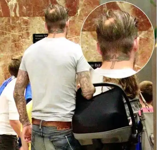 这次贝克汉姆上热搜,好秃然