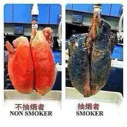 我做了蛋白埋线减肥,有个穴位长脓疱了,是怎么会事啊,请问老师们