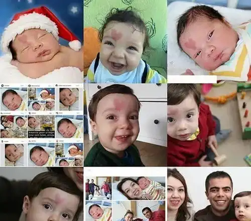 5年前在土耳其,那个额头顶着爱心降世的宝宝,现在咋样了