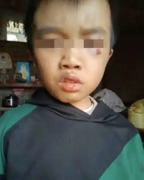 虎毒不食子,12岁男孩被禽兽不如的父母活活打死