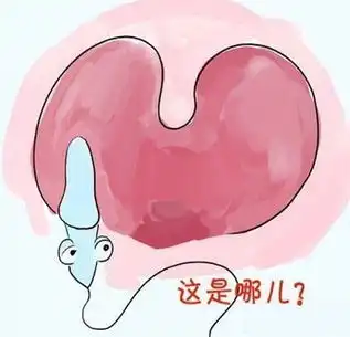 趣味图解精子的15种悲催死法