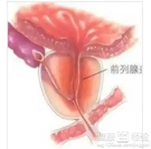 前列腺炎的危害严重吗