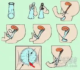 图真人演示女用避孕套的用法