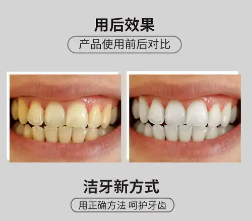 牙粉美白去黄去牙渍男女专用洗牙齿神器口臭刷结石牙斑抖音正品