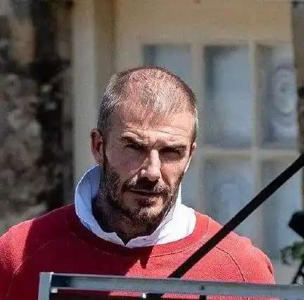 脱发意味着变丑,明星也逃不掉,教你保持头发浓密小妙招