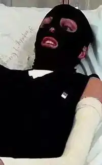 历经烧伤截肢毁容,不但完成铁人三项,怀个孕轰动全澳洲在无尽黑暗的隧道尽头,总会有光亮的到来