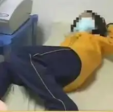 台女童天天吃炸鸡致肾萎缩