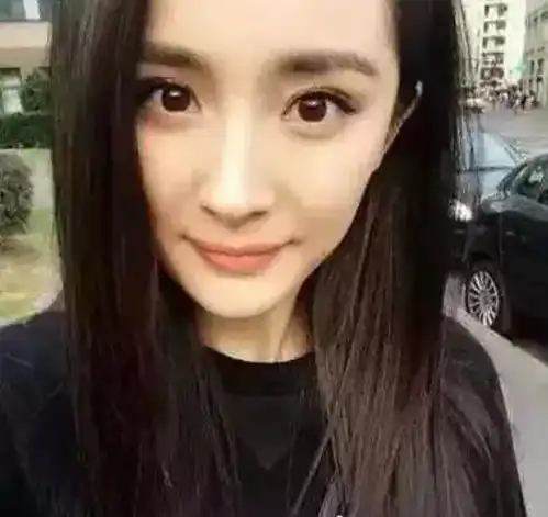 双眼皮到底要不要开眼角