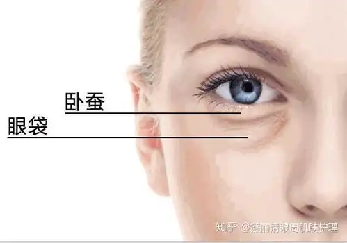 请问这是卧蚕还是眼袋