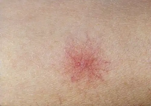 29岁男子肝功能全部丧失,不抽烟喝酒,医生怎能常吃这毒物