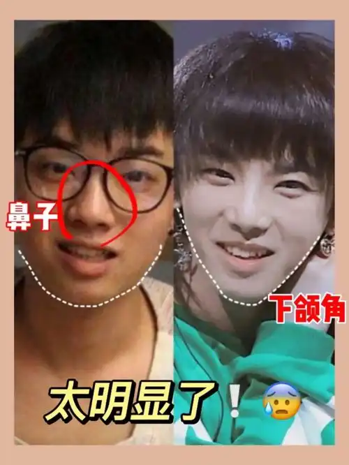 表面英俊潇洒,实则丑头怪脸的5大男星,个个整得帅气