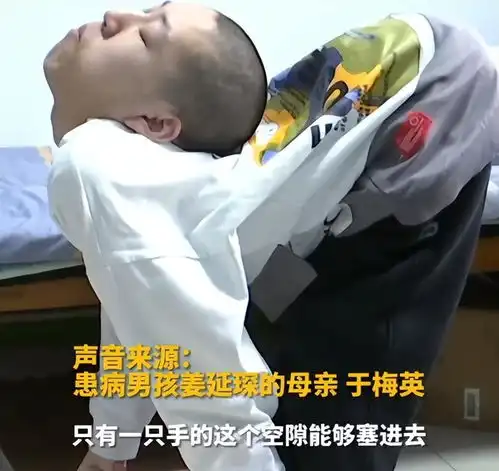 折叠男孩跪着上课考上大学,祝他手术顺利