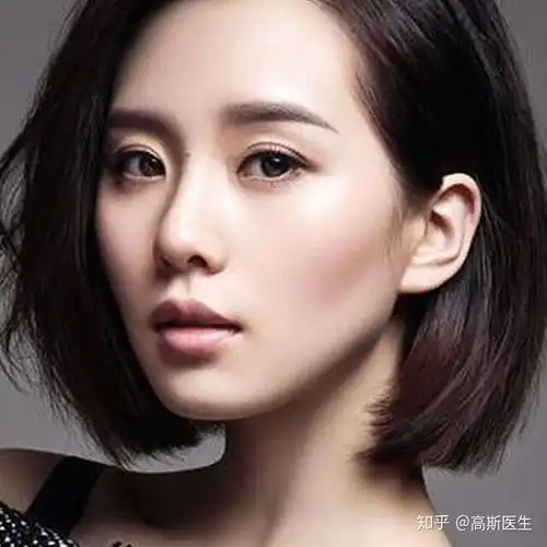 为什么好多单眼皮女孩要割双眼皮