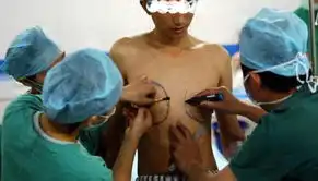 高清组图实拍变性手术全过程