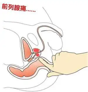 前列腺痛要重视,警惕给身体带来的四大危害