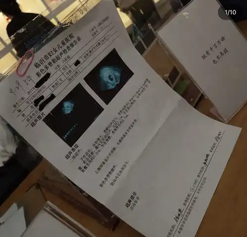 失恋博物馆故事有多扎婚纱还可以忍,看到b超单泣不成声