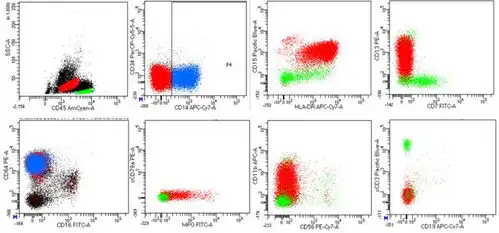 细胞毒治疗相关髓系肿瘤1例