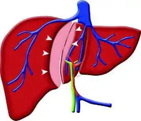 金线葛保肝护肝的神奇功效