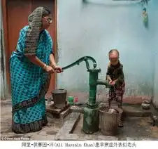 印度一名男孩患早衰症外表似老头图