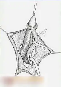 科学探秘女变男神秘变性手术全程图解