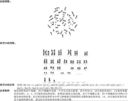 细胞毒治疗相关髓系肿瘤1例