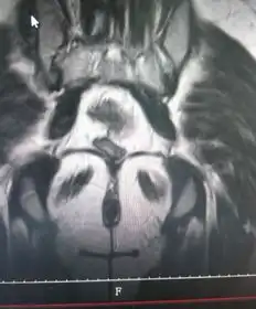 搞笑段子同学脚特臭,丧尽天良的那种臭,结果一天打球脚扭到了