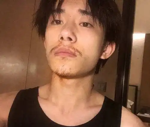 男孩子第一次刮胡子的最佳年龄是多少医生别小于这岁数