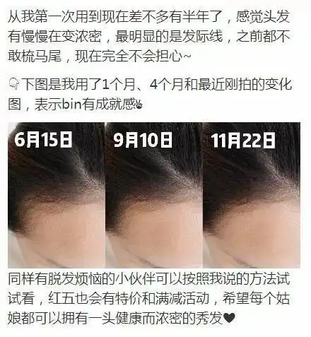 护发继娜扎杨幂之后,刘亦菲郑爽竟然也成了脱发大军主力