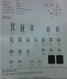 染色体核型分析报告谁能看懂是男是女