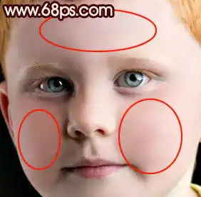 photoshop完美的消除小男孩满脸的斑点
