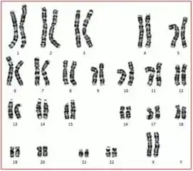 染色体核型分析重要吗
