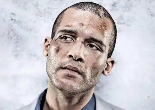 心理疾病危害大,精神科专家讲解抑郁症的相关要点