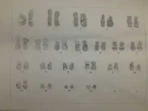 染色体核型分析结果是46,是什么意思啊附染色体照片一张,最后面显示的xy是什么意思