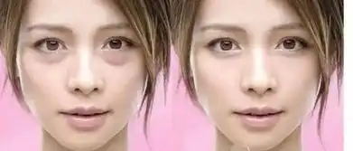 120秒让眼袋消失,瞬间减龄15岁,功效相当于两只玻尿酸