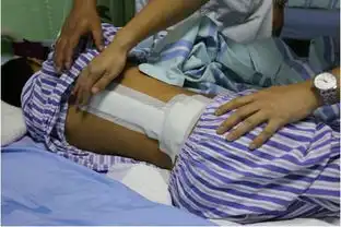 12岁安徽男孩脊柱畸形十年,终于在这挺直了腰