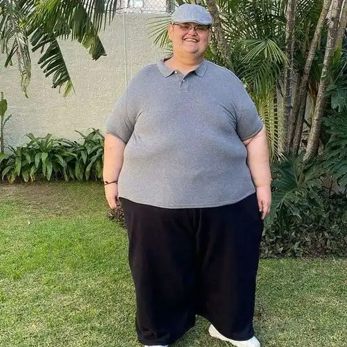 世界上最胖的男人体重曾高达半吨,减掉三百公斤后,完全判若两人