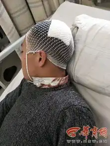 开学第一天14岁男生上学路上被抢劫围殴组图