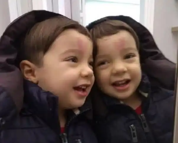 额头上带着心形记号的宝贝已经长大,现在的模样,有点可爱