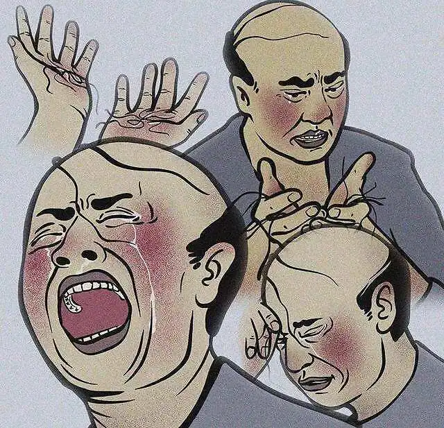 头顶脱发严重怎么办教你快速解决头顶大事